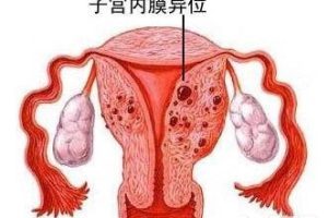培生素与波鲁精:男性精子质量提升方案的主要区别
