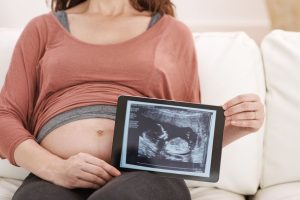 试管婴儿的微刺激方案:流程、注意事项及预防措施