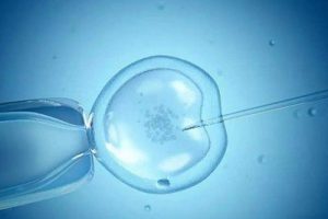 试管婴儿拮抗剂方案:步骤、用药注意事项及关键预防措施