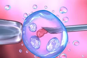 试管婴儿促排卵方案:人工周期与自然周期的选择方法