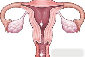 什么是试管婴儿的自然周期方案?它适合哪些人群?