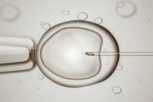 试管婴儿的促排卵方案:短周期方案是什么?哪种方案最适合你呢?