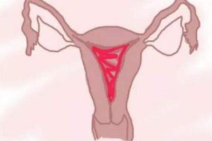 试管婴儿长周期方案(超长方案):促排卵过程需多长时间?详细流