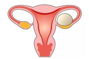 第三代试管婴儿:成功率及其优缺点全面分析