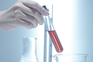 想要进行试管婴儿?首先需满足这四项基本条件!