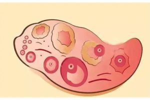 高龄女性的生育选择:自然怀孕还是试管婴儿?关键问题解析