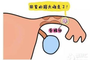 高龄怀孕:如果你超过35岁开始怀孕,以下是你需要了解的关键信