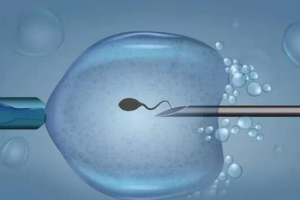 高龄备孕与怀孕:不可忽视的风险及科学应对措施