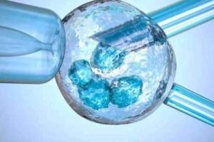 高龄女性试管婴儿:医院选择、成功率及关键建议