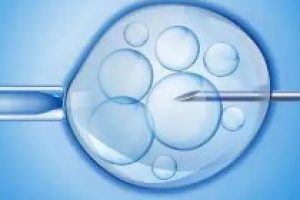 绝经女性进行试管婴儿的年龄限制究竟是多少?