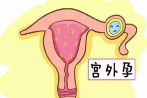 高龄女性进行试管婴儿的全面指南:成功案例与必要检查解析