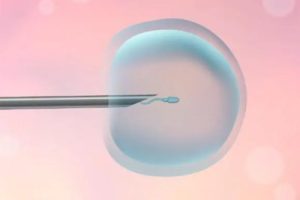 全面了解人工授精:费用、适合人群及注意事项