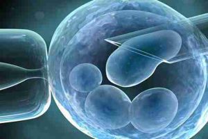 辅助生殖技术:费用、成功率及重要注意事项