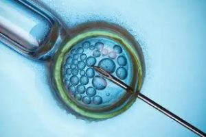 辅助生殖技术(通常称为“试管婴儿”):费用问题全面解读