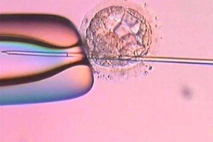 辅助生殖技术全面指南:IUI与试管婴儿的费用、医保情况与术前