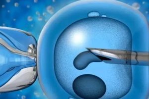 胚胎植入后的五个早期迹象——你是否经历过?