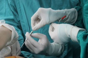 试管婴儿胚胎培养:费用标准及流程详解