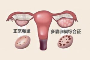 超长方案:试管婴儿中理想的鲜胚移植选择