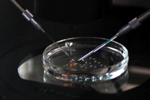 试管婴儿胚胎培养:重要步骤及时间分析