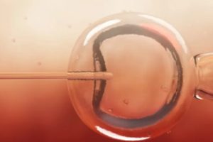 取卵术后如果出现腹水该怎么办?这里有一份科学处理的指南!