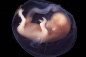 试管婴儿胚胎培养全面解析:时间安排、费用估算及重要注意事项